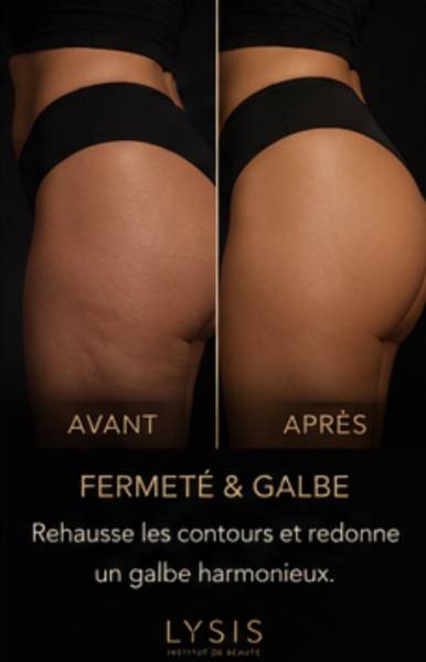 découvrez nos offres de soin minceur mag sculpt gainant et galbant pour hommes et femmes à Richemont proche de Thionville, Fameck et Amnéville en Moselle
